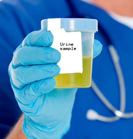 urine analysis